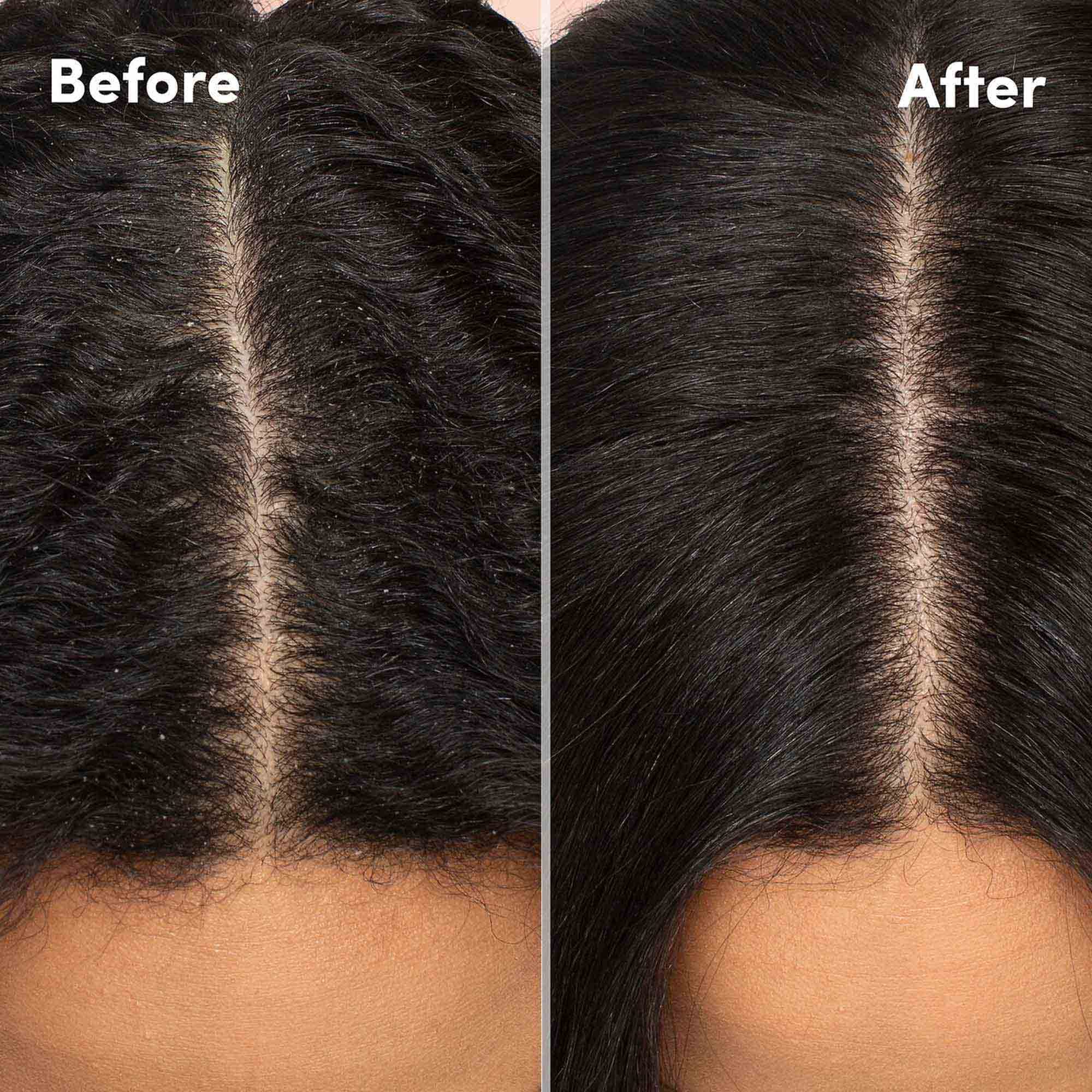 Mizani Scalp Care Antidandruff Shampoo